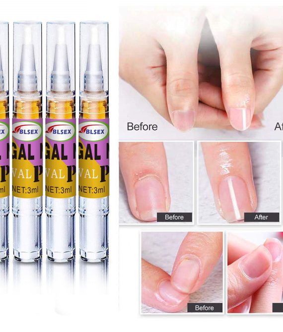 ΛΑΔΑΚΙ ΕΠΙΔΙΟΡΘΩΣΗΣ ΝΥΧΙΩΝ 3ML X 4 ΤΕΜΑΧΙΑ