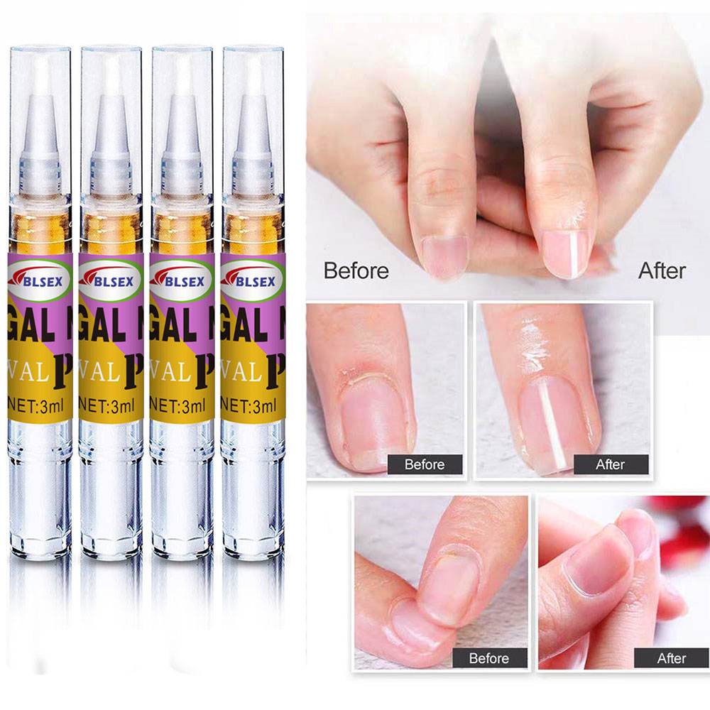 ΛΑΔΑΚΙ ΕΠΙΔΙΟΡΘΩΣΗΣ ΝΥΧΙΩΝ 3ML X 4 ΤΕΜΑΧΙΑ
